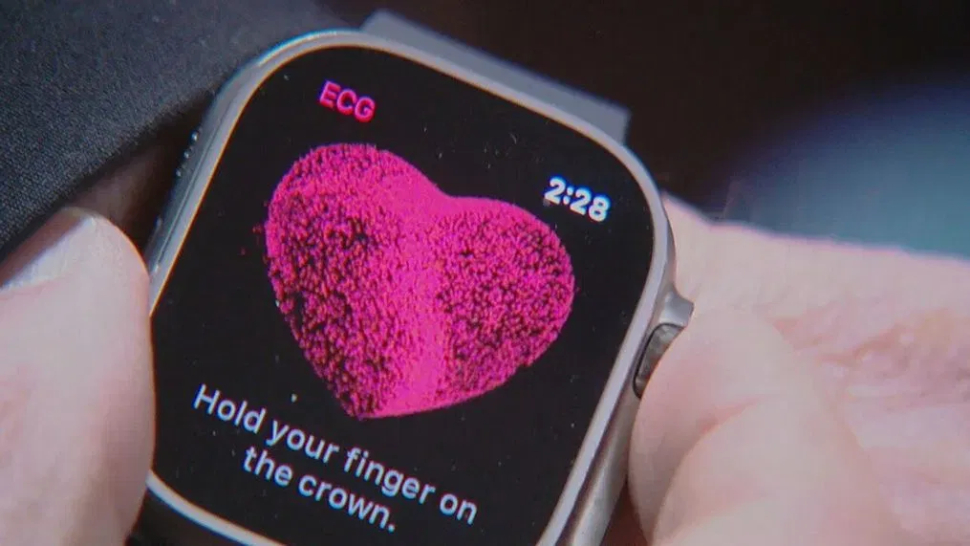 Apple Watch cứu người phụ nữ khỏi cục máu đông trong động mạch phổi