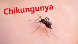  Dịch Chikungunya là gì, phòng tránh ra sao?
