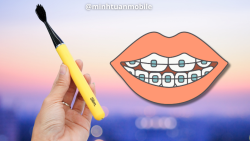 Top bàn chải điện dưới 1 triệu đáng mua cho đồng niềng